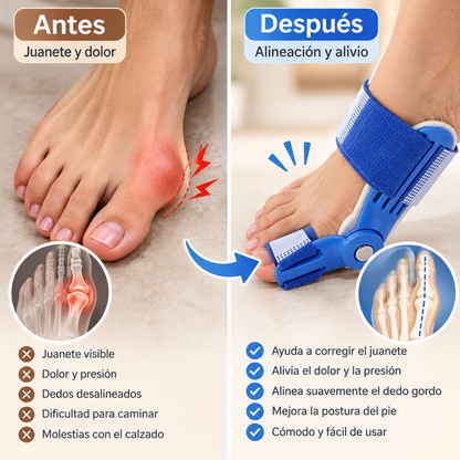 Corrector de Juanetes Ajustable